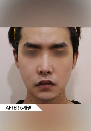 After