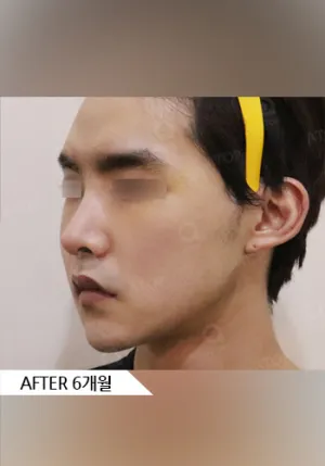 After