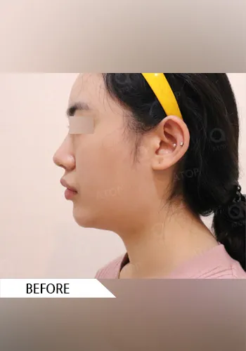 Before