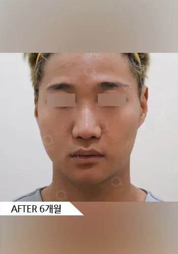 After