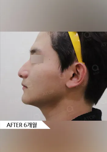 After