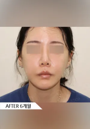 After
