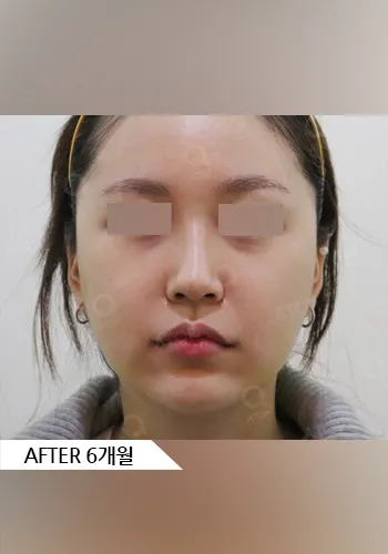 After