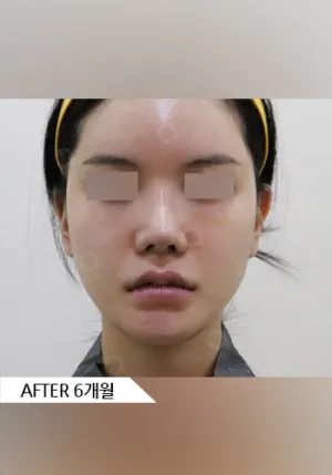 After