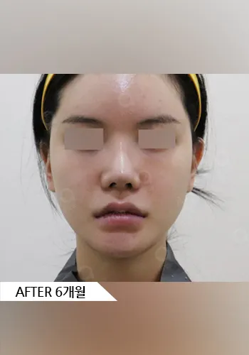 After