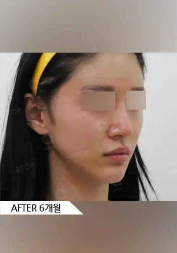 After