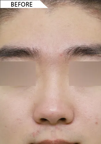 Before