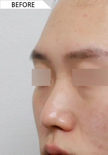 Before