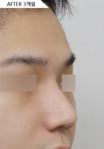 After