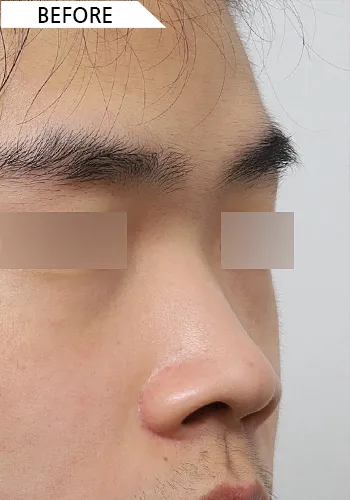 Before