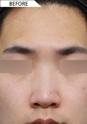 Before