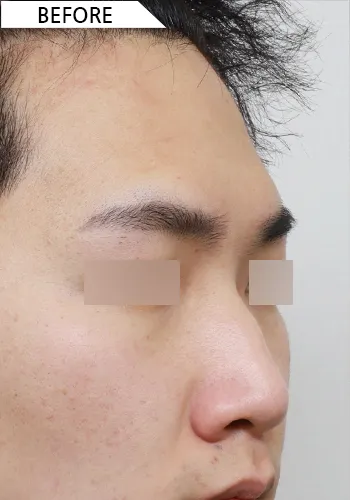 Before
