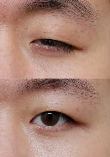 After