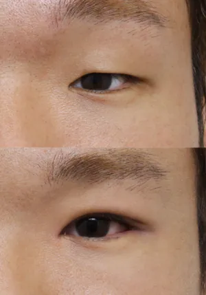 After