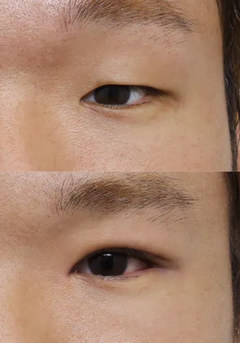 After