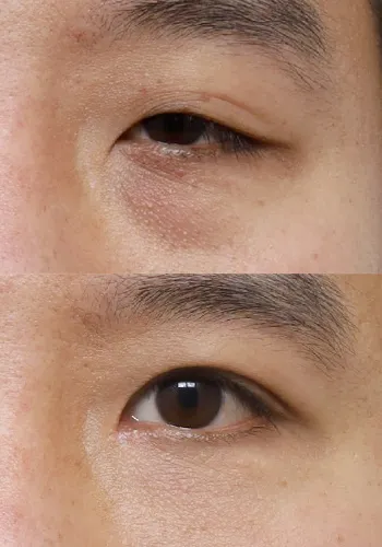 After
