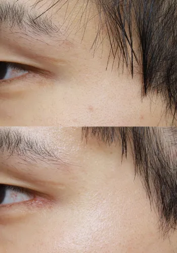 After