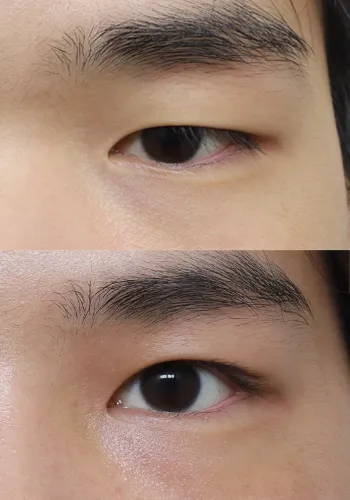 After