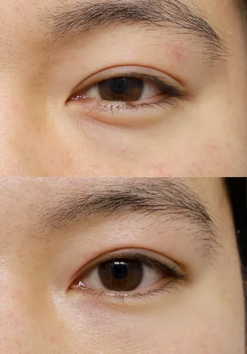After
