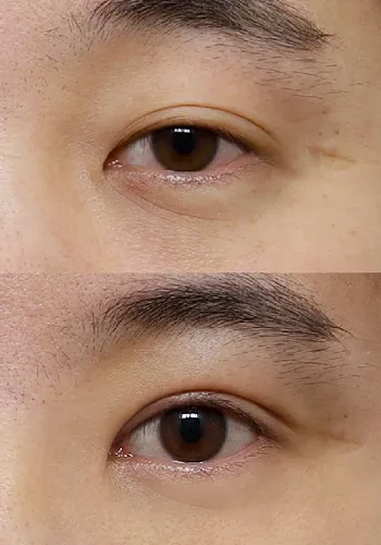 After