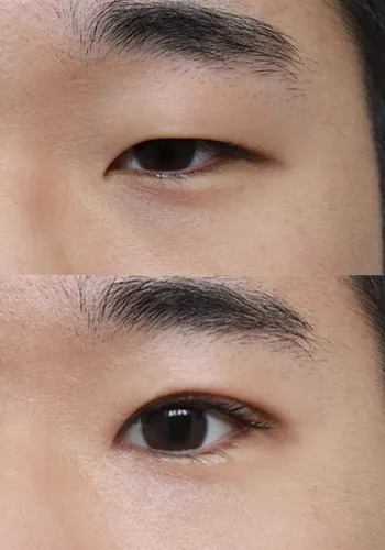 After