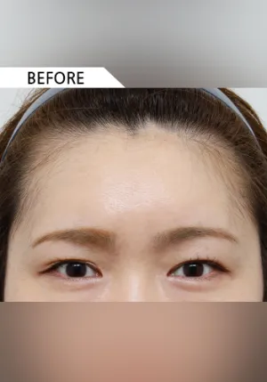 Before