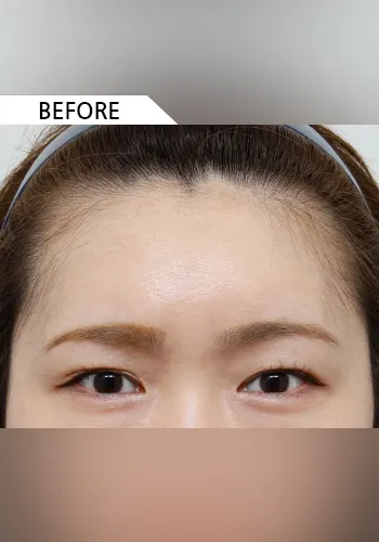 Before