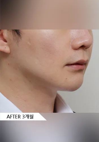 After