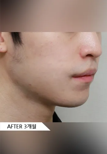 After