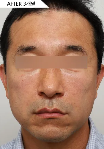 After