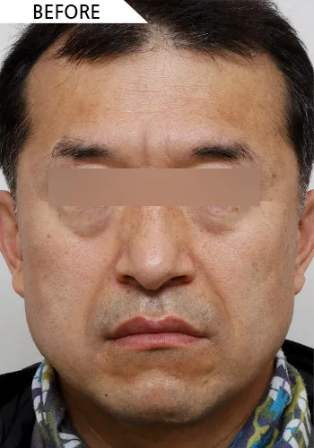 Before
