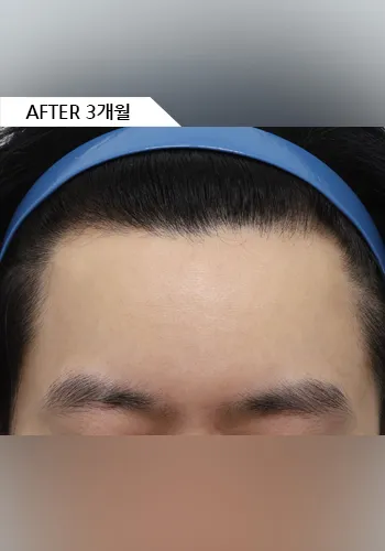 After