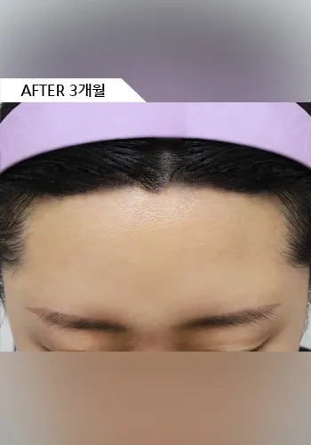 After