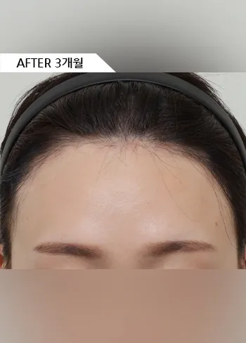 After