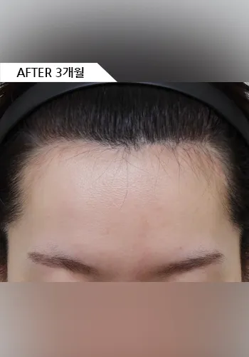 After
