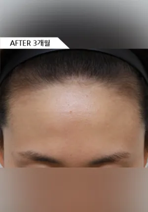 After