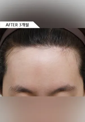 After