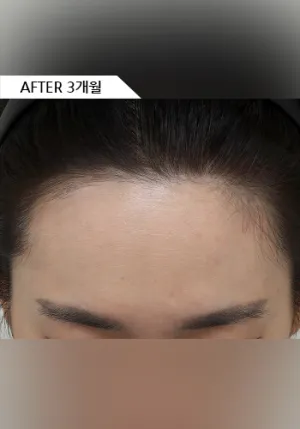 After