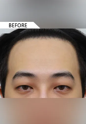 Before