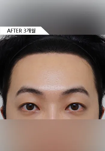After