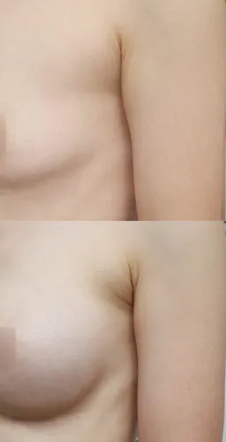After