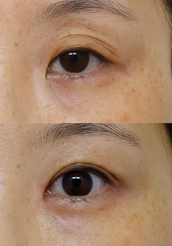 After