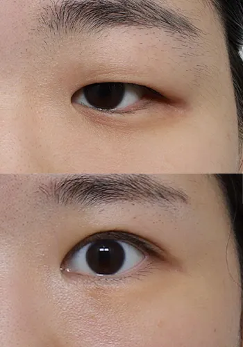 After