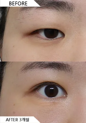 Before