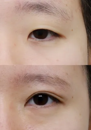 After