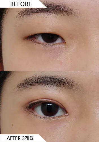 Before