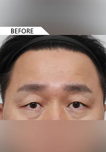 Before