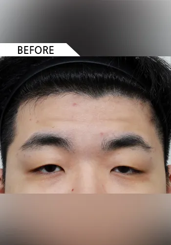 Before