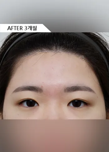 After