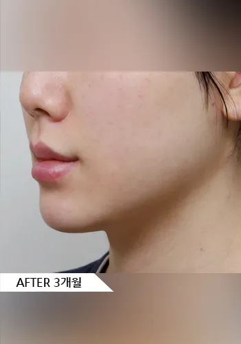 After